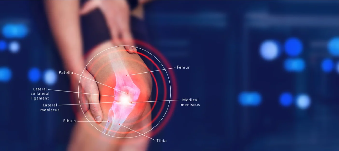 How Much Does ACL Surgery Cost in Delhi, India?